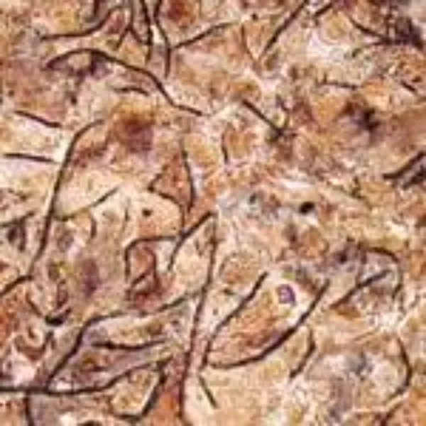 Unibar 300